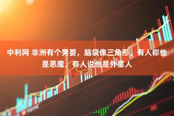 中利网 非洲有个男婴，脑袋像三角形，有人称他是恶魔，有人说他是外星人